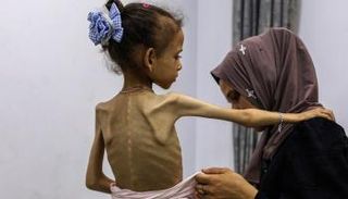 أم فلسطينية مع ابنتها التي تعاني من سوء تغذية