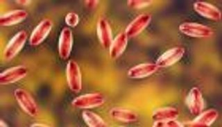 فيديو صادم يكشف ما يحدث للجسم بعد الإصابة بـ«الطاعون الأسود»