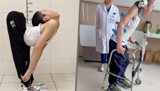 الولد المطوي 