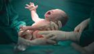 بعد تصدرها عالميا.. تحركات رسمية في مصر للحد من الولادة القيصرية بحلول نهاية 2025