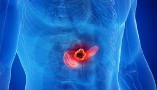 التدخين قد يزيد بشكل كبير من خطر الإصابة بسرطان البنكرياس