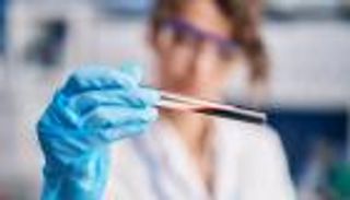 ثورة طبية.. اختبار يكتشف التصلب الجانبي الضموري قبل عقد من الزمن