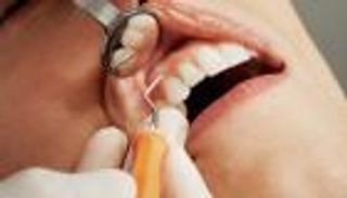 تحذير طبي: نزيف اللثة قد يكون إشارة مبكرة للسرطان