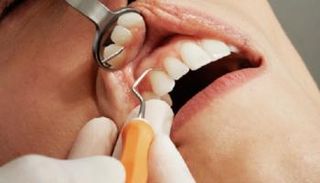 نزيف اللثة قد يكون إشارة مبكرة للسرطان