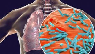 علماء يكشفون سر قوة السل