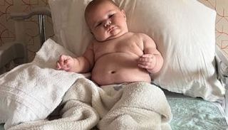 تزايد ملحوظ في ظاهرة ولادة أطفال بأحجام استثنائية