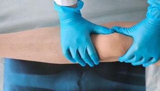 تقصير الساق- أرشيفية