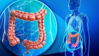خمسة مؤشرات غير مؤلمة قد تنذر بسرطان الأمعاء