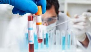 اختبار بسيط يتنبأ بخطر الكبد قبل ظهور الأعراض 