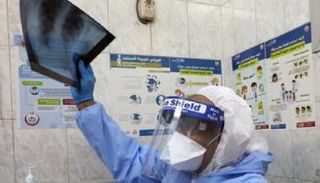 الأشعة أظهرت تحسنا واضحا في الحالات التي اعتمدت على بروتوكول أدوية فيروس سي