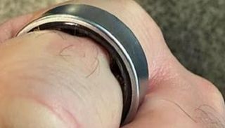 خاتم سامسونغ الذكي تسبب في تورم إصبع اليوتيوبر البريطاني دانيال روتار