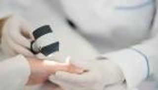 أزمة طب الجلد تتفاقم في فرنسا.. والإضرابات تضغط النظام الصحي