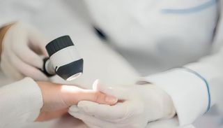 أزمة طب الجلد تتفاقم في فرنسا