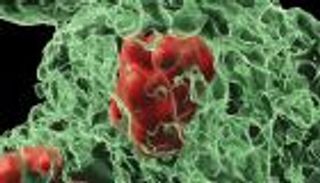 علماء يكشفون عن خلايا &laquo;لا تموت&raquo;.. هل يفسر ذلك مرض السرطان؟