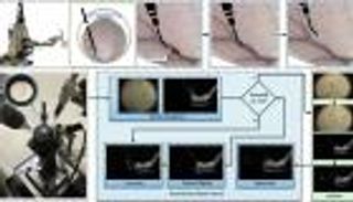 روبوت يدخل الأوردة الدقيقة للعين.. خطوة نحو علاج فقدان البصر