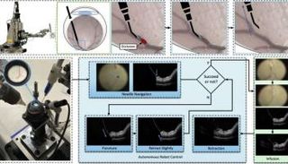 نظام روبوتي يمكنه أداء جراحة دقيقة جدا لعلاج انسداد الأوردة الشبكية