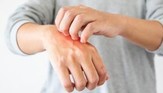 تحذير صحي عاجل من ارتفاع حاد في حالات الجرب ببريطانيا