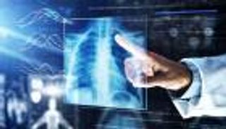 أمريكا تعتمد أداة أشعة بالذكاء الاصطناعي لتشخيص أمراض متعددة