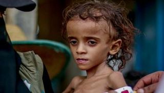 طفله يمنية تعاني الجوع في الحديدة.. أرشيفية