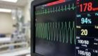 ابتكار تقنية هجينة جديدة لعلاج تسارع القلب البطيني