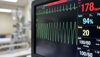 ابتكار تقنية هجينة جديدة لعلاج تسارع القلب البطيني