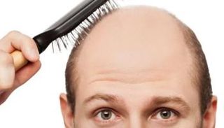 علاج تساقط الشعر لم يعد سهلاً