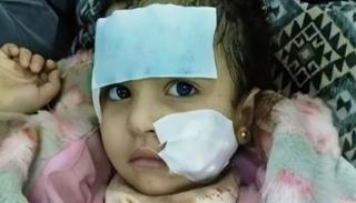 الطفلة المصابة داخل السيرك القومي 