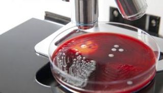 دواء ضغط الدم يقهر البكتيريا المقاومة