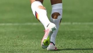 جوارب ممزقة في كأس العالم 2026